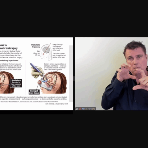 Linguistics and Considerations: Skeletal System