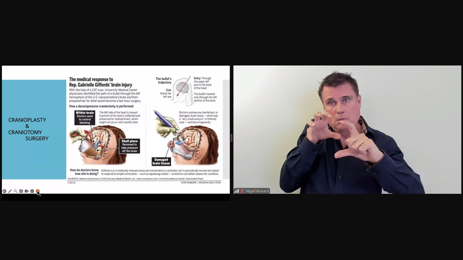 Linguistics and Considerations - Skeletal System_Overlay Image