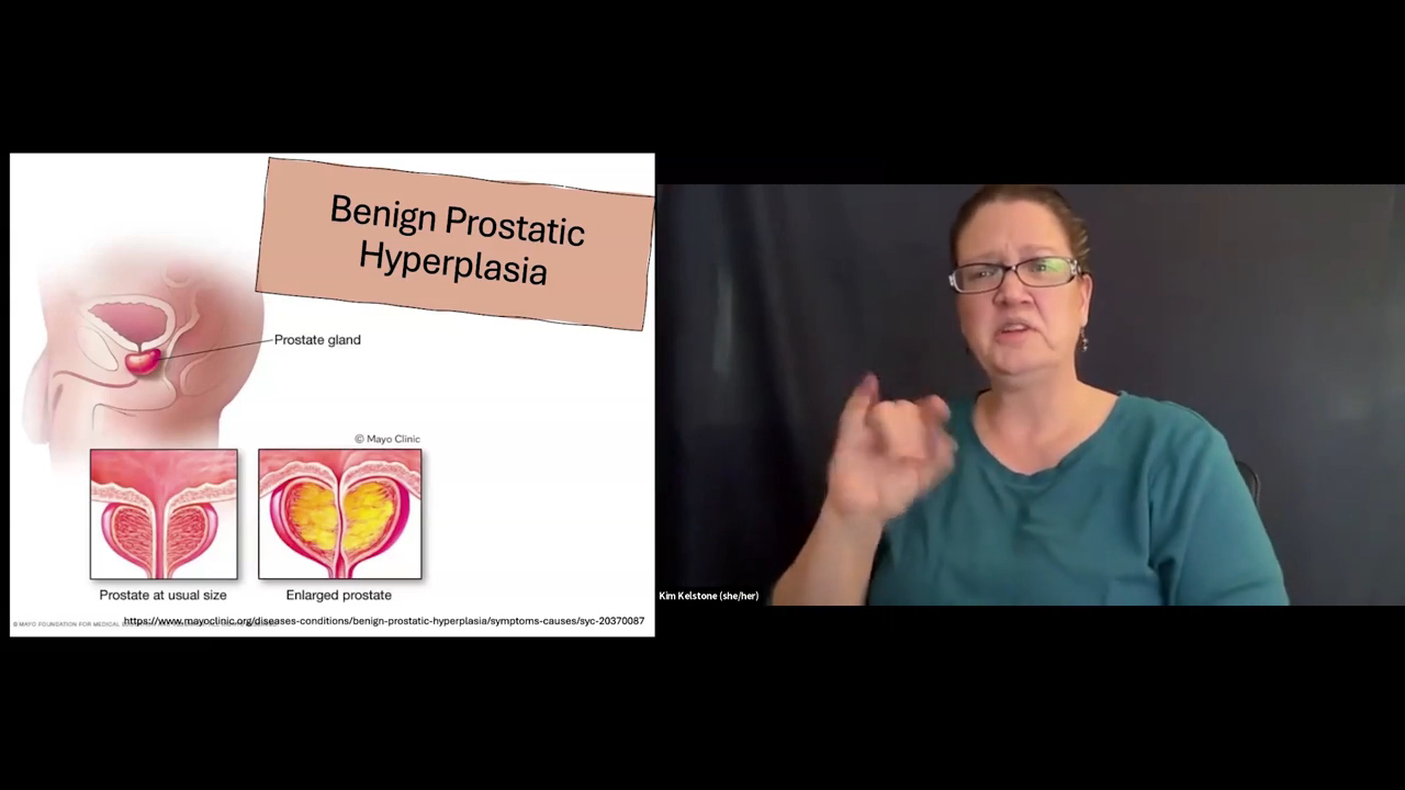 A split-screen presentation slide. On the left side, a medical presentation slide titled "Benign Prostatic Hyperplasia" displays anatomical diagrams from the Mayo Clinic. The diagrams include a cross-section of the male pelvic region highlighting the prostate gland, alongside two close-up comparisons: one labeled "Prostate at usual size" and another labeled "Enlarged prostate" showing a narrowed urethra. On the right side, a woman with short brown hair, glasses, and a teal shirt is actively presenting using sign language against a dark background. Her name, "Kim Kelstone (she/her)", is printed in small text below her video window.